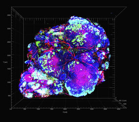 Transparent tumor tomography visualising tumor microenvironment, showing a mouse model for HER2-positive breast cancer with hypoxic areas of cancer cells in green - CUF06167