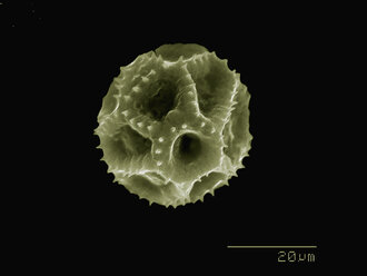 Dandelion pollen imaged in a scanning electron microscope - CUF07625