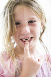 Portrait of girl pointing at missing teeth - ISF04527