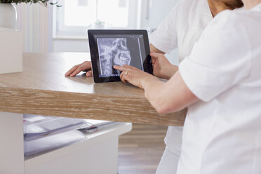 Dentists looking at digital tablet with x-ray image of jaw on screen - CUF16471