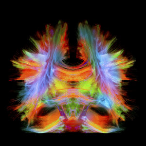 Vollständige Hirntraktographie mit künstlerischen Farben. Dies ist eine vollständige Hirnverfolgung, die aus einer superauflösenden Rekonstruktion von 0,6 Kubik-mm stammt. Vorderansicht. - CUF28358