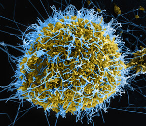 Filamentous Ebola virus particles (colored blue) budding from a chronically-infected VERO E6 cell (colored yellow) - CUF28514