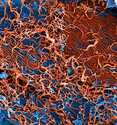 Filamentous Ebola virus particles (colored red) budding from a chronically-infected VERO E6 cell (colored blue) - CUF28516