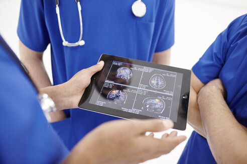 Ärzte sehen sich Scans auf einem digitalen Tablet an - CUF28710