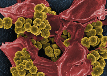 Eingefärbtes SEM von Methicillin-resistenten Staphylococcus aureus (MRSA)-Bakterien bei der Phagozytierung durch eine menschliche neutrophile weiße Blutzelle - CUF29926