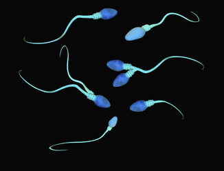 Illustration of abnormalities and deformities of human sperm cells - CUF29935