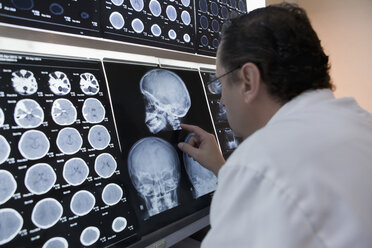 Arzt zeigt auf Röntgenbild des Schädels auf Leuchttisch - ISF09580