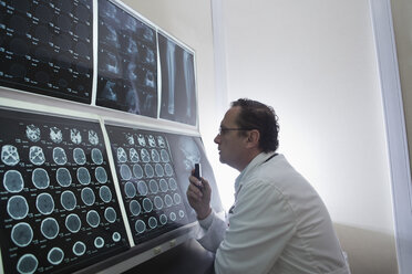 Doctor staring at scans of the brain on lightbox - ISF09581