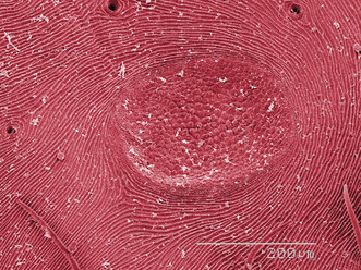 Farbiges SEM des Hinterleibs der Orbweberspinne - CUF30743