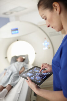 Röntgenassistentin betrachtet Gehirnscan-Bild auf digitalem Tablet - CUF35992