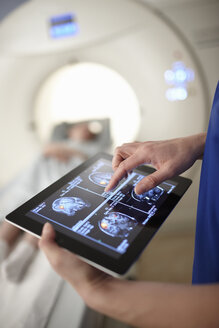 Röntgenassistentin betrachtet Gehirnscan-Bild auf digitalem Tablet - CUF35993
