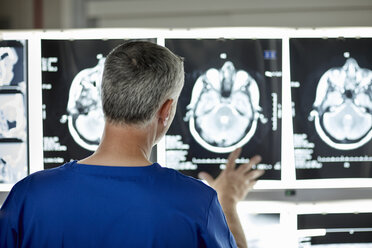 Radiologe beim Betrachten von Gehirnscans - CUF36011