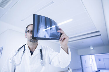 Ein Radiologe betrachtet die Röntgenergebnisse im Krankenhaus - CUF37627