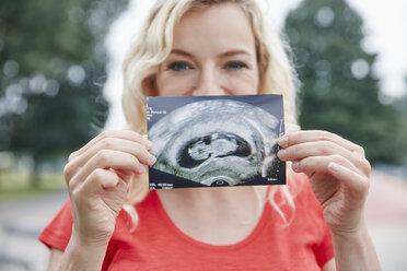 Porträt einer glücklichen schwangeren Frau, die ein Ultraschallbild im Freien hält - RHF02047