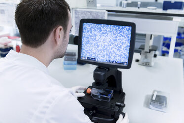 Krebsforschungslabor, männlicher Wissenschaftler studiert Zellen unter dem Mikroskop mit Computerbildschirm - CUF38182