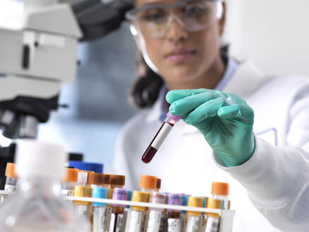 Feamle scientist preparing a blood sample for clinical testing in the laboratory - ABRF00208