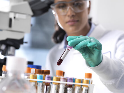 Feamle-Wissenschaftler bei der Vorbereitung einer Blutprobe für klinische Tests im Labor - ABRF00208