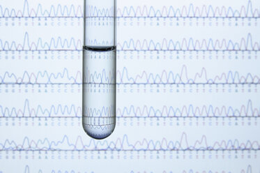 Reagenzglas mit Flüssigkeit und Computermonitor, der die Ergebnisse der automatischen DNA-Sequenzierung anzeigt - CUF39608