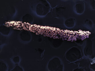 Hochvakuum-SEM-Bild eines Staubblattes der Blüte von Brassica rapa oleifera - CUF41008