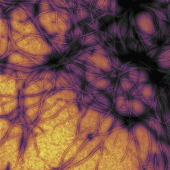 Elektronenmikroskopische Aufnahme, Prionproteinfibrillen - ISF18428