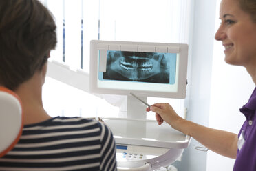 Patient betrachtet Röntgenbild von Zahnimplantaten - ISF18474