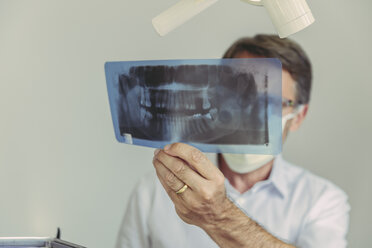 Zahnarzt betrachtet Röntgenbild vor der Behandlung - MFF04554