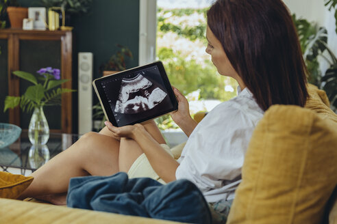 Frau betrachtet Ultraschallbild des ungeborenen Kindes auf der Couch - MFF04704