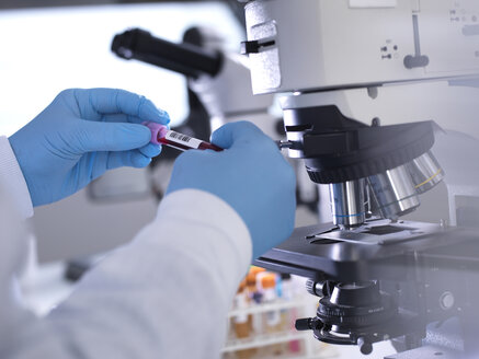 Abgeschnittene Hände eines männlichen Wissenschaftlers, der Blutproben unter dem Mikroskop im Labor hält - CAVF50474