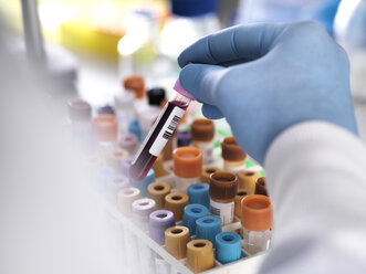 Cropped hand of laboratory technician holding blood sample for medical testing - CAVF53186