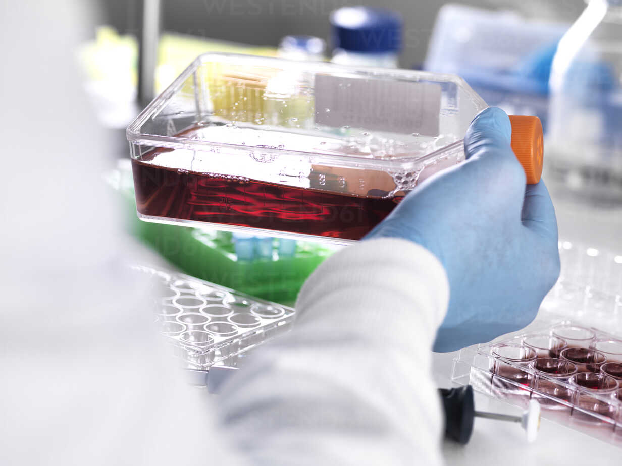 Nahaufnahme eines Labortechnikers, der eine Blutprobe in einem Behälter für medizinische  Tests hält, lizenzfreies Stockfoto