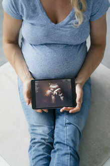 Schwangere Frau sitzt auf dem Boden und zeigt ein Ultraschallbild auf einem Tablet - KNSF05212