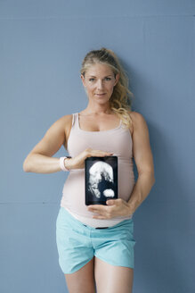 Porträt einer lächelnden schwangeren Frau, die ein Ultraschallbild auf einem Tablet zeigt - KNSF05224