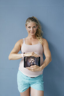 Porträt einer lächelnden schwangeren Frau, die ein Ultraschallbild auf einem Tablet zeigt - KNSF05226