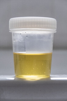 Urinprobe in einem Becher - MELF00198