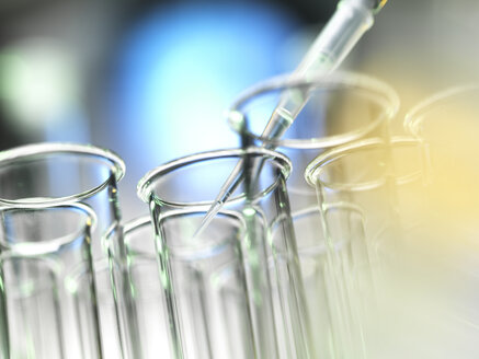 Scientist pipetting a sample into a test tube during a experiment in the laboratory - ABRF00252