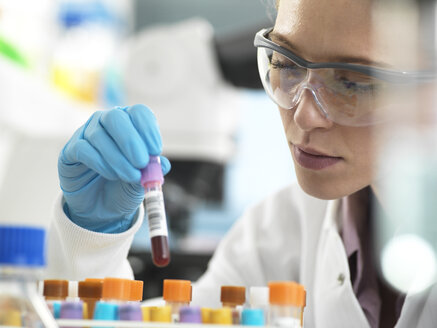 Health Screening, Scientist holding a tube containing a blood sample ready for analysis in the laboratory - ABRF00325