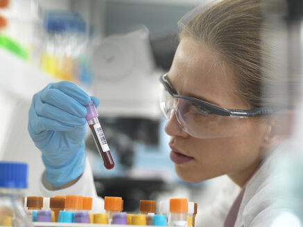 Gesundheitsscreening, Wissenschaftler, der ein Röhrchen mit einer Blutprobe für die Analyse im Labor hält - ABRF00327