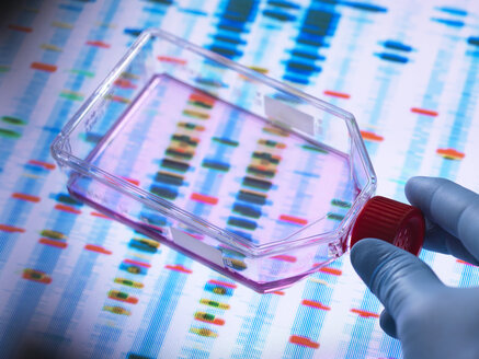 Gentechnik, Wissenschaftler betrachtet Zellen in einem Kulturgefäß mit einem DNA-Profil auf einem Bildschirm im Hintergrund, das die Genbearbeitung veranschaulicht - ABRF00334
