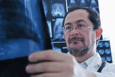Arzt bei der Untersuchung eines Röntgenbildes - CUF49478