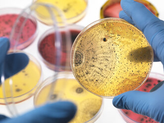 Wissenschaftlerin bei der Untersuchung von Petrischalen mit Bakterienwachstum im Labor - ABRF00340