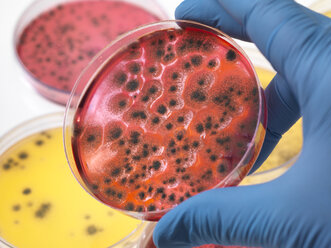 Wissenschaftlerin bei der Untersuchung von Petrischalen mit Bakterienwachstum im Labor - ABRF00344