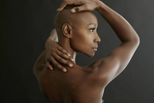 African American woman holding her bald head - BLEF07024