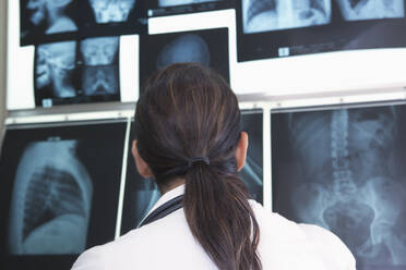 Hispanischer Arzt bei der Untersuchung von Röntgenbildern im Krankenhaus - BLEF10235