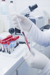 Hispanischer Wissenschaftler beim Pipettieren einer Blutprobe im Labor - BLEF14226