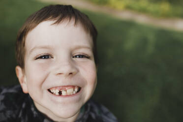 Portrait of a boy with freckles and crooked teeth - KMKF01044