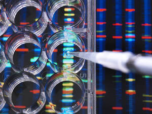 DNA-Forschung, DNA-Proben in einer Multiwell-Platte, bereit für die Analyse, mit DNA-Ergebnissen im Hintergrund - ABRF00478