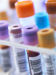 Eine Reihe menschlicher Blutproben, die auf die Untersuchung im Labor warten - ABRF00627