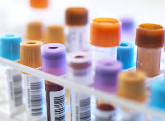 Eine Reihe menschlicher Blutproben, die auf die Untersuchung im Labor warten - ABRF00628