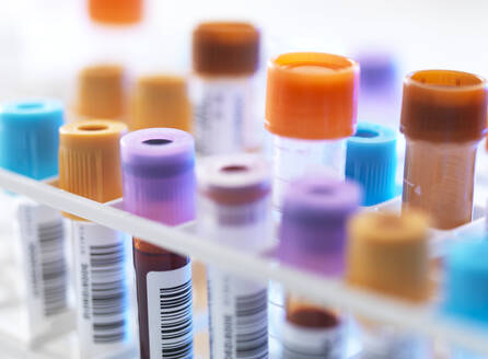 A row of human blood samples awaiting testing in the lab - ABRF00628