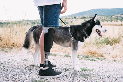 Junger Mann mit Beinprothese und Hund auf Feldweg - CJMF00015
